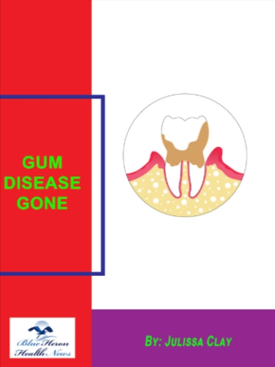 Gum Disease Gone Reviews